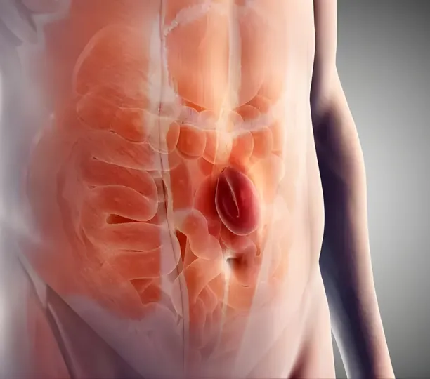 Expert Hernia Surgeon in Dubai: Comprehensive Surgical Care by Skilled General Surgeons - kiolopobgofit